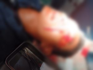 Tim Reskrim Polsek Pagelaran Memburu Pelaku Pembacokan di Pasar Pagelaran