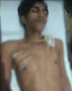 Pemuda Pekon Sukawangi Ditusuk Pencuri di Rumahnya