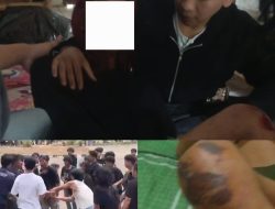 Keluar dari GSG, Mahasiswa FP Unila Diduga Dikeroyok: Korban Lapor Polisi